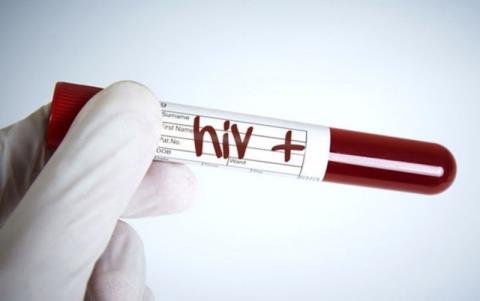 Combien de temps dure la fenêtre sérologique du VIH ? Symptômes pendant la fenêtre sérologique