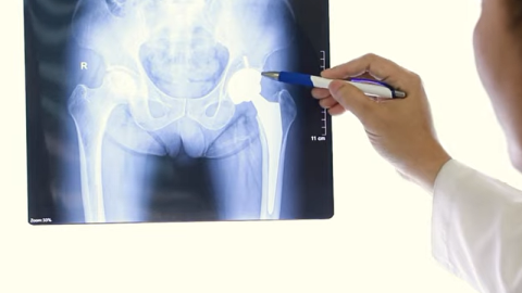 Detailed information about the Superpath hip replacement technique