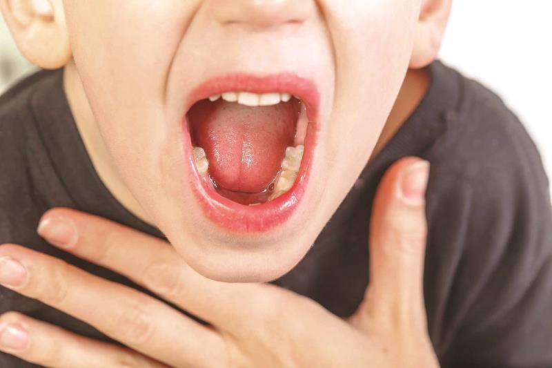 ¿Qué causa la amigdalitis en la base de la lengua?  Conoce los síntomas y cómo tratar