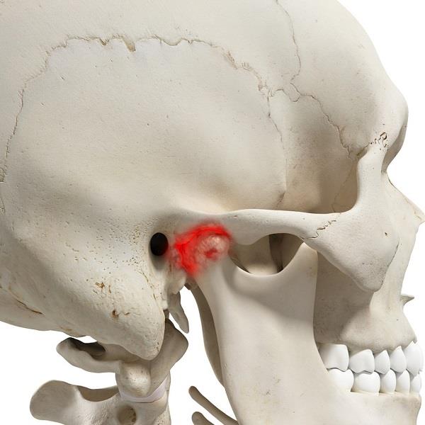 Боль в челюсти: причины, диагностика и лечение