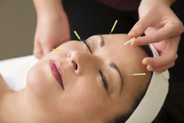 Akupunktur dalam pengobatan gangguan vestibular