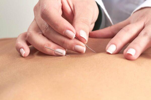 Akupunktur tedavisi idrar retansiyonu ve bilmediğiniz şeyler