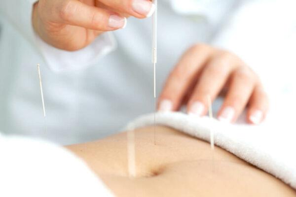 ¿La acupuntura es efectiva para la disfunción eréctil?