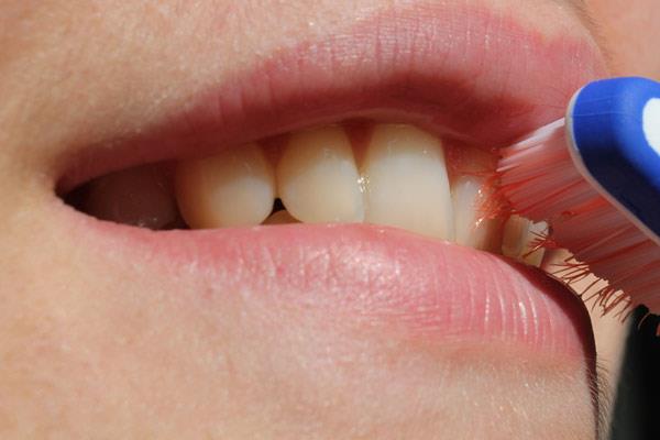 Saignement des gencives : un mauvais signe de santé bucco-dentaire