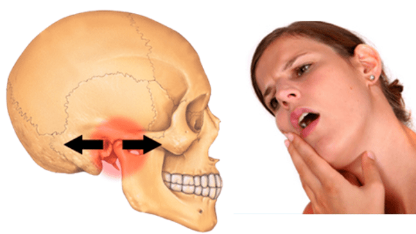 Cos'è il morso inverso?  Cause e trattamenti