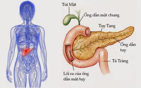 Endocrine pancreatic tumors: Dangerous cancer and what you need to know