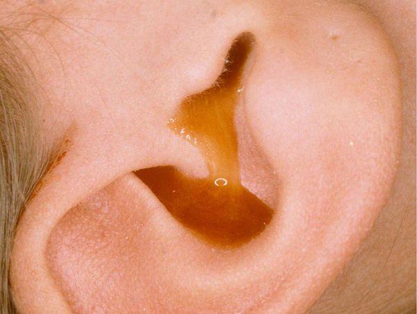 Bau sperma: Cara menukar dan nasihat daripada doktor