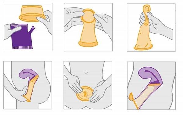 Cara menggunakan kondom dengan aman: Pengetahuan untuk semua orang!