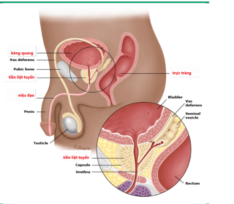 What you need to know about prostate enlargement