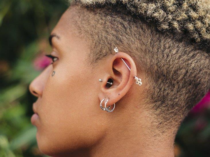 What is an ear keloid?  Can it be cured?