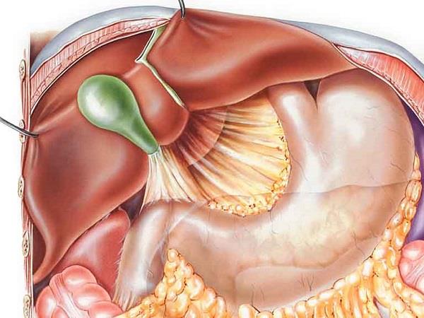 膽汁反流是胃食管反流嗎？