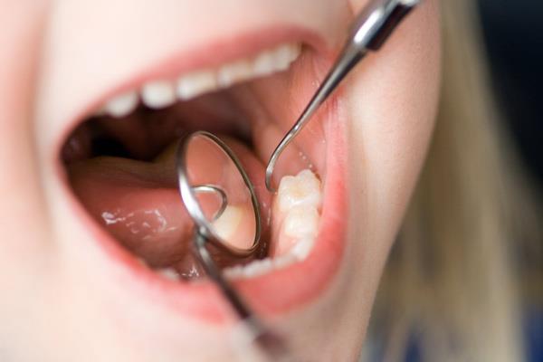 Obturations dentaires et choses à savoir