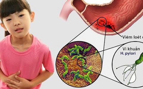 Gastritis in children: What parents need to care about