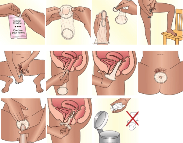 Preservativi femminili e cosa devi sapere