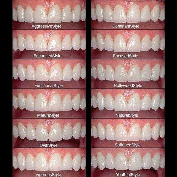 Escolha a forma e a cor corretas do dente