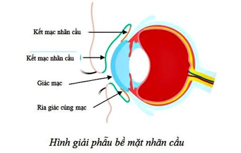 Foreign body in the eye: Causes, diagnosis and treatment