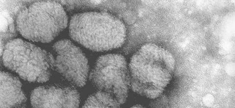What is the difference between smallpox and chickenpox?