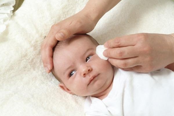Niedrożność gruczołu łzowego u dzieci