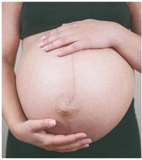 Pregnancy after cesarean section: Things to note
