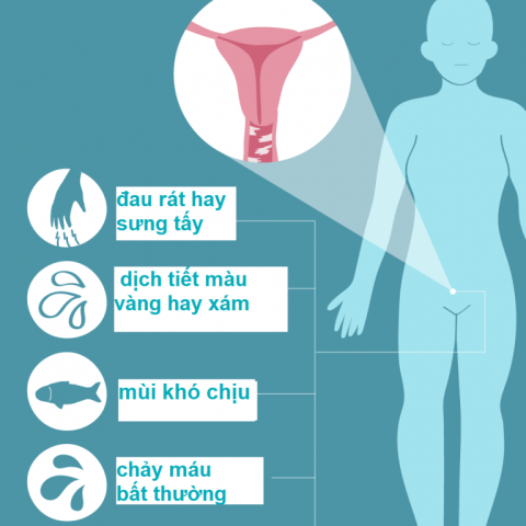 Vaginitis: Todo lo que necesitas saber