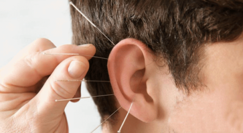 Cure sudden deafness with acupuncture effective?