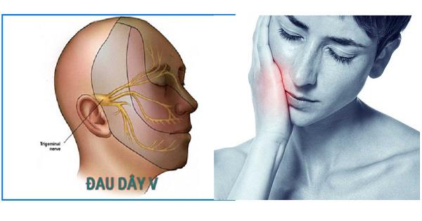 Douleur à la mâchoire : causes, diagnostic et traitement