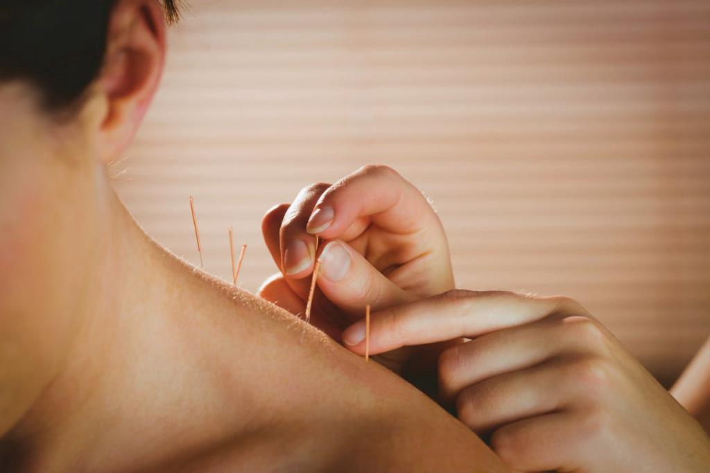 Haruskah akupunktur menyembuhkan herniasi diskus?