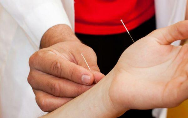 Acupuncture pour la douleur au poignet : effets, méthodes d'acupuncture et notes