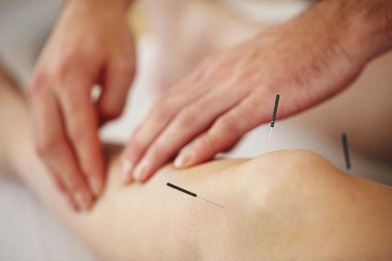 Gut için akupunktur tedavisi nasıl düzeltilir ve güvenlidir