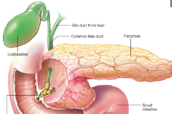 Czy autoimmunologiczne zapalenie trzustki to rak trzustki?