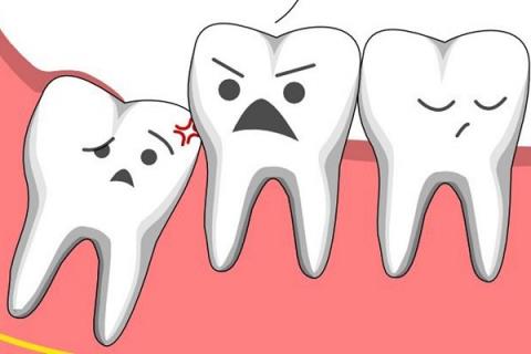 Wisdom tooth pain and pain relief methods you should know
