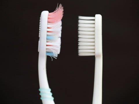 Proper and effective brushing: Easy or difficult?