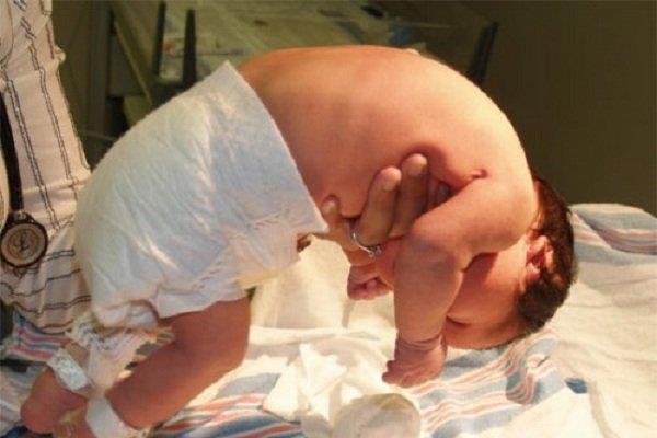 What you need to know about how dangerous spinal muscular atrophy is?
