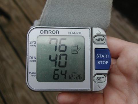 Low blood pressure in young people: What you need to know