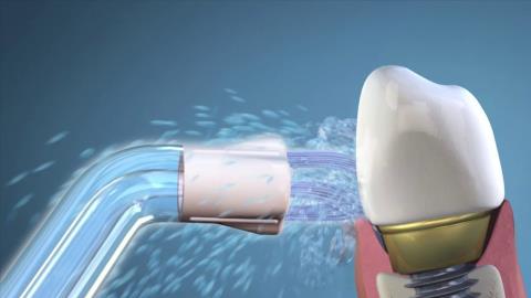 Water flosser: An effective dental care tool