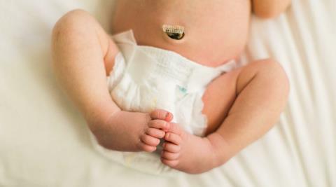 Newborn umbilical cord: Related issues