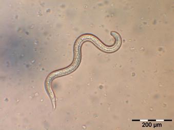 Correct understanding of tapeworm infection