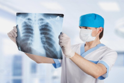 Things to pay attention to when taking care of lung cancer patients