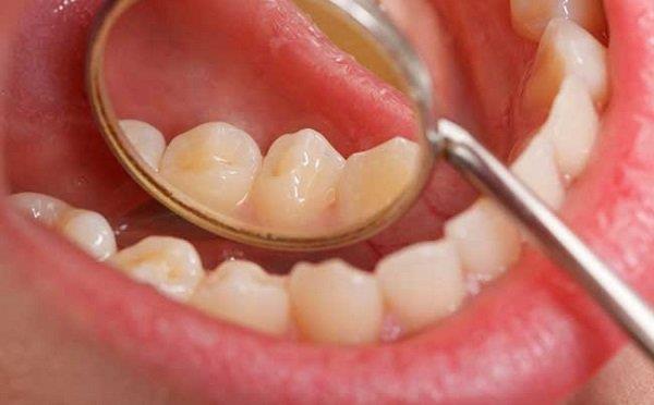 Können Patienten mit Mundhöhlenkrebs geheilt werden?