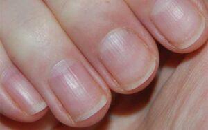 What does the semicircle on your fingernail tell you?