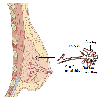 乳管の拡張：女性の悩み