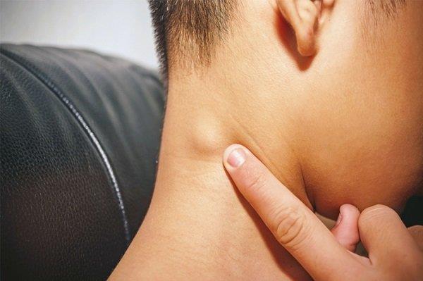 首の後ろのリンパ節の腫れ：この兆候について知っておくべき真実