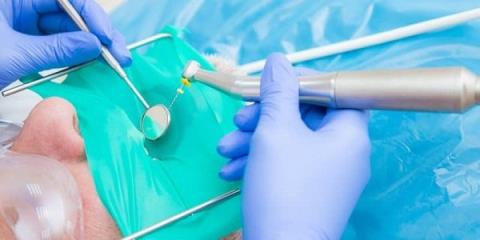 Answers to some frequently asked questions about root canal treatment