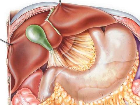 Est-ce que le reflux biliaire est un reflux gastro-oesophagien ?