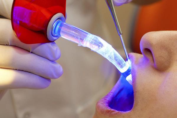 Wypełnienia dentystyczne i co warto wiedzieć