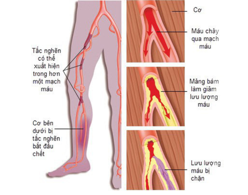 Arteries: Blood vessels that carry nutrients to the body