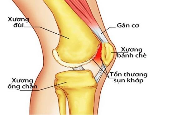 The kneecap: Structure and function