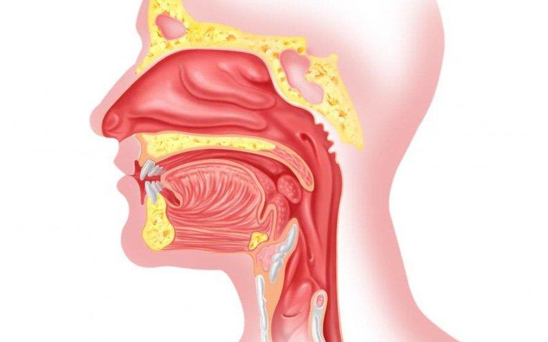 Что нужно знать о раке горла