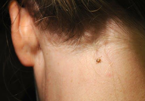 Anaplasmosis: are tick bites dangerous?